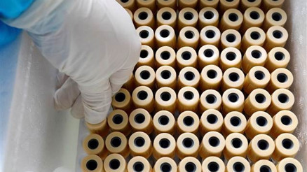 Covid-19 test sonucu ne zaman, kaç günde çıkar E Nabız Koronavirüs test sonucu nasıl sorgulanır İşte detaylar