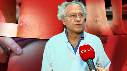 İstanbulda sivrisinek tehlikesi Prof. Dr. Yılmaz türünü açıkladı: Asya Kaplan Sivrisineği kâbusu İstanbulda sivrisinek tehlikesi Prof. Dr. Yılmaz türünü açıkladı: Asya Kaplan Sivrisineği kâbusu