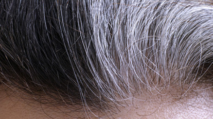 Beyazlayan saçların eski rengine dönmesi mümkün mü