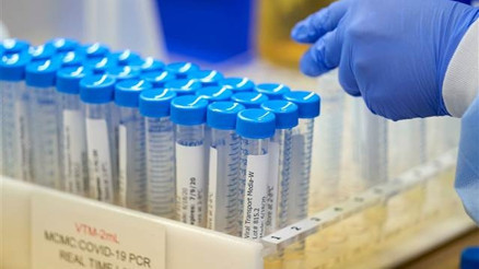 Covid-19 test sonucu ne zaman, kaç günde çıkar E Nabız Koronavirüs (corona virüs) sonuç sorgulama nasıl yapılır İşte detaylar