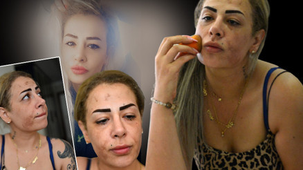 Güzellik merkezi hayatını alt-üst etti Gelen cevapla ikinci şoku yaşadı