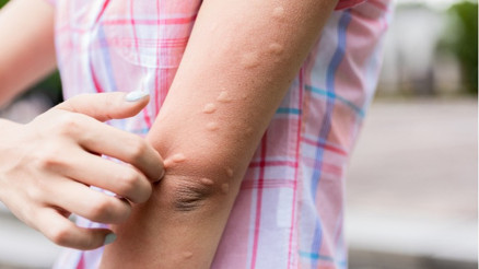 Covid-19 Sivrisinekler İle Bulaşır Mı Sağlık Bakanlığı Yanıtladı Covid-19 Sivrisinekler İle Bulaşır Mı Sağlık Bakanlığı Yanıtladı