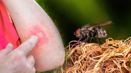 Ah, karasinek ısırdı... diyoruz ama onlar karasinek değil İşte İstanbullunun yeni derdi... Ah, karasinek ısırdı... diyoruz ama onlar karasinek değil İşte İstanbullunun yeni derdi...