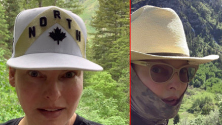 Linda Evangelista: Tüm vücudum deforme oldu, insan içine çıkamıyorum Linda Evangelista: Tüm vücudum deforme oldu, insan içine çıkamıyorum