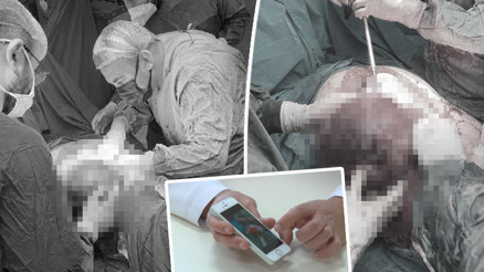 Şikayetleri 4 ay önce başlamıştı... Doktorlar da şaşkına döndü: Basketbol topu büyüklüğünde