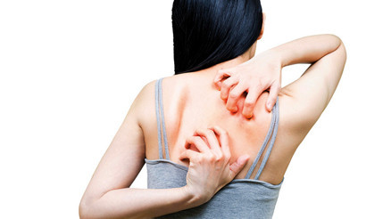 Korkmayın ürtiker bulaşıcı değil Korkmayın ürtiker bulaşıcı değil