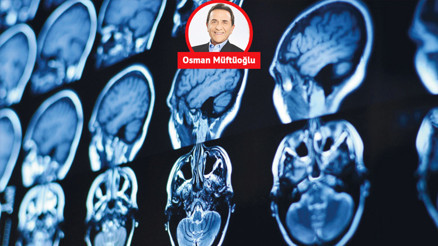 COVID-19 beyni küçültüyor