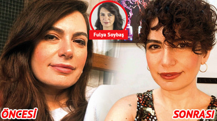 Saçlarım döküldü kel kaldım... Şimdi daha az kadın mıyım