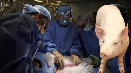 Domuzdan insana organ nakli Türkiye için de umut oldu...