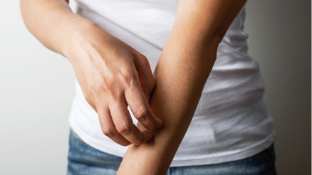 Temre Neden Olur, Nazardan Olur Mu Temre Yarasına Ne İyi Gelir Temre Neden Olur, Nazardan Olur Mu Temre Yarasına Ne İyi Gelir