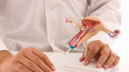 Labioplasti Nedir, Kimlere Yapılır Labioplasti Ameliyatı Hakkında Merak Edilenler