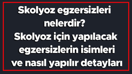 Skolyoz egzersizleri nelerdir Skolyoz için yapılacak egzersizlerin isimleri ve nasıl yapılır detayları