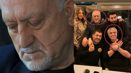 Cengiz Kurtoğlunun saldırdığı Mustafa Can konuştu Cengiz Kurtoğlunun saldırdığı Mustafa Can konuştu