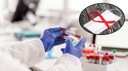 AIDS’le savaşa COVID-19 engeli