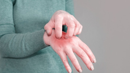 Dikkat uyuz var... Ortak kullanılan şallardan, kabindeki kıyafetlerden bile bulaşıyor