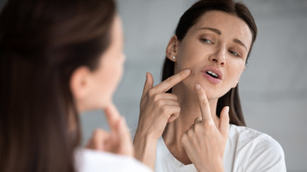 Sivilce sıkmak felce neden olur mu Özellikle tehlike üçgenine çok dikkat...