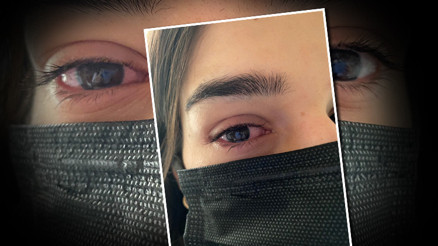 Şimdi de gözlerde virüs salgını Adenovirüse karşı uyarı geldi