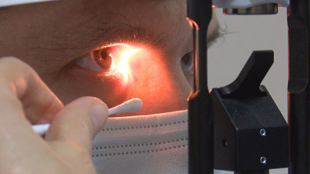 Adenovirüs (konjonktivit) nedir İşte konjonktivit hakkında bilgiler