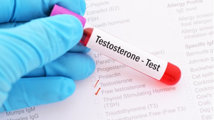 Mutluluğun anahtarı: Testosteron Mutluluğun anahtarı: Testosteron