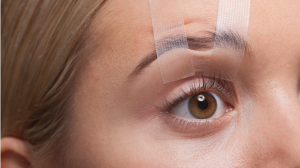 Göz Kapağı Estetiği (Blefaroplasti) Nedir, Nasıl Yapılır