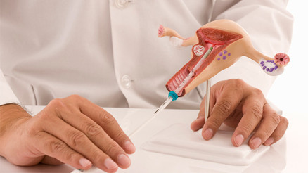 Mesane ve rahim sarkması