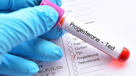 Progesteron Hormonu Nedir, Ne İşe Yarar Progesteron Hormonu Yüksekliği ve Düşüklüğü Etkiler Progesteron Hormonu Nedir, Ne İşe Yarar Progesteron Hormonu Yüksekliği ve Düşüklüğü Etkiler