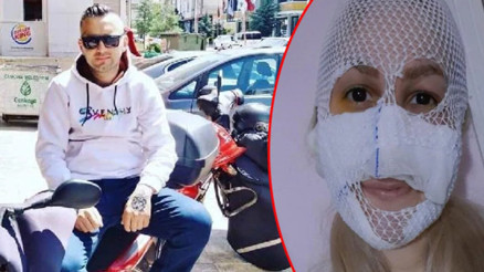 Sultanın yüzüne kimyasal madde atmıştı Yakalanan zanlı tutuklandı Sultanın yüzüne kimyasal madde atmıştı Yakalanan zanlı tutuklandı