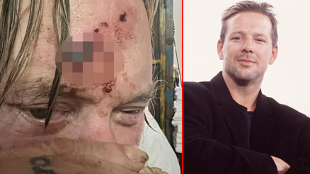 Eski günlerim geride kaldı: Ünlü oyuncudan kan revan paylaşım... Yüz hatlarımı bozup attılar demişti Eski günlerim geride kaldı: Ünlü oyuncudan kan revan paylaşım... Yüz hatlarımı bozup attılar demişti