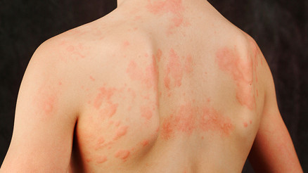 15 dakikadan fazla dışarıda duramıyor… ‘Okula yürüyerek gitmek onu öldürebilir