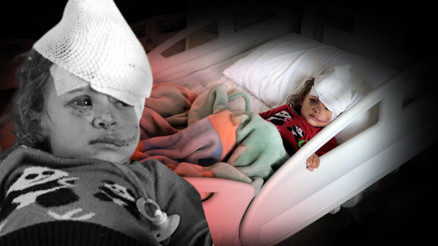 3 yaşındaki çocuğu eşek ısırdı Göz kapağı kopan Fatmaya boynundan alınan doku ile yeni göz kapağı yapıldı