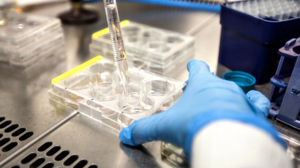 Sperm kalitesini belirleyen parametreler nelerdir, ne anlama gelir