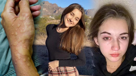 Dünyada 32 kişi bu hastalığı yaşıyor: Ağlamak bile yasak En son bir yıl önce su içtim