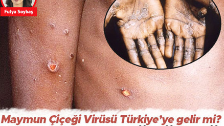 Maymun çiçeği virüsü Türkiyeye gelir mi