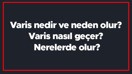 Varis nedir ve neden olur Varis nasıl geçer Nerelerde olur Varis nedir ve neden olur Varis nasıl geçer Nerelerde olur