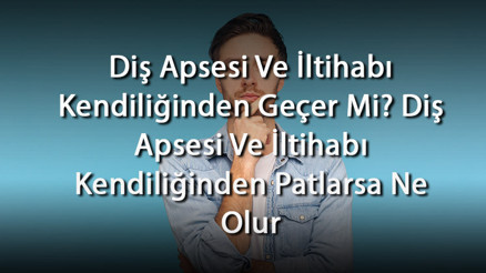 Diş Apsesi Ve İltihabı Kendiliğinden Geçer Mi Diş Apsesi Ve İltihabı Kendiliğinden Patlarsa Ne Olur