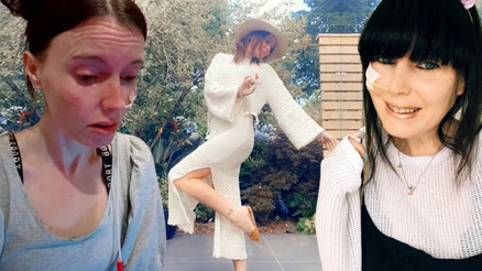 50 farklı kişilikle yaşıyor Günde en az 20 kez vücudumu ele geçiriyorlar