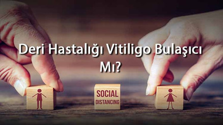 Deri Hastalığı Vitiligo Bulaşıcı Mı İnsandan İnsana Geçer Mi