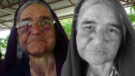 Adanada 70 yaşındaki kadın, sürüye karışan kuzusunu almak isterken feci şekilde darp edildi