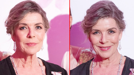 Bir zamanlar güzelliğin simgesiydi: Estetikle arası yok