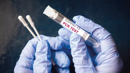 Covid testi sonucu ne zaman çıkar PCR testi sonucu kaç günde, kaç saatte çıkar İşte koronavirüs test sonucu hakkında bilgiler