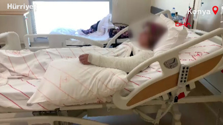 Kimyasallı dehşet Yüzüme attığı sıvı, demir kapının boyasını dahi eritmiş