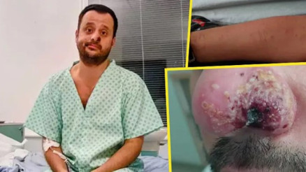 3 virüsü de yendi, damgalanmayı yenemedi