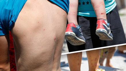 İstanbulda Aedes sivrisineği tehdidi Sayıları giderek artıyor... Uzman isimden önemli uyarı İstanbulda Aedes sivrisineği tehdidi Sayıları giderek artıyor... Uzman isimden önemli uyarı