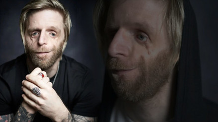 Ailesi görünüşü nedeni ile doğduktan 36 saat sonra terk etti Bir kız beni öptükten sonra hayatım değişti