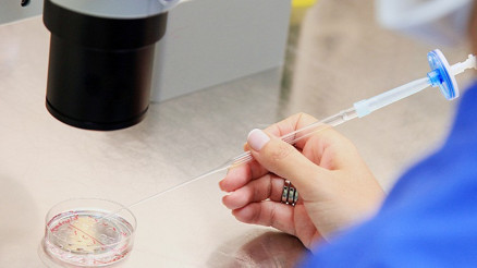 Erkeklerde sperm kalitesi nasıl anlaşılır ve ölçülür Sperm kalitesi neden düşer ve nasıl arttırılır Erkeklerde sperm kalitesi nasıl anlaşılır ve ölçülür Sperm kalitesi neden düşer ve nasıl arttırılır