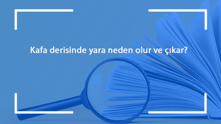 Kafa derisinde yara neden olur ve çıkar Kafa derisindeki yara nasıl geçer Kafa derisinde yara neden olur ve çıkar Kafa derisindeki yara nasıl geçer