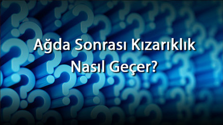 Ağda Sonrası Kızarıklık Nasıl Geçer Ağda Sonrası Oluşan Kızarıklıklara Ne İyi Gelir Ve Ne Yapılır