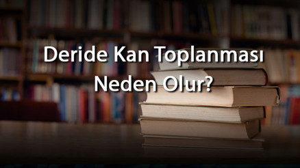 Deride Kan Toplanması Neden Olur Deride Kan Toplanması Nasıl Geçer Ve Ne Yapılmalıdır