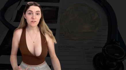 10 SORUDA meme asimetrisi ve Poland Sendromu | Yaz ayları benim için kabustu