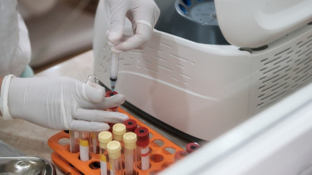 Sertleşme bozukluğu tedavisinde PRP uygulaması Sertleşme bozukluğu tedavisinde PRP uygulaması